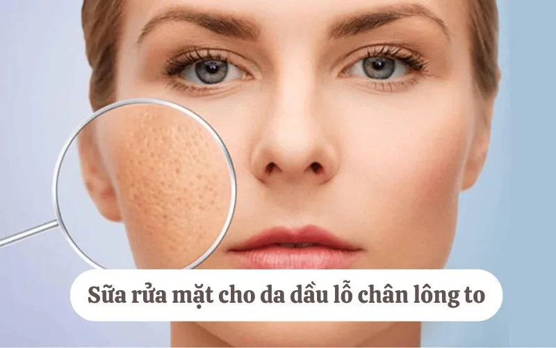 Da dầu mụn nên dùng sữa rửa mặt nào