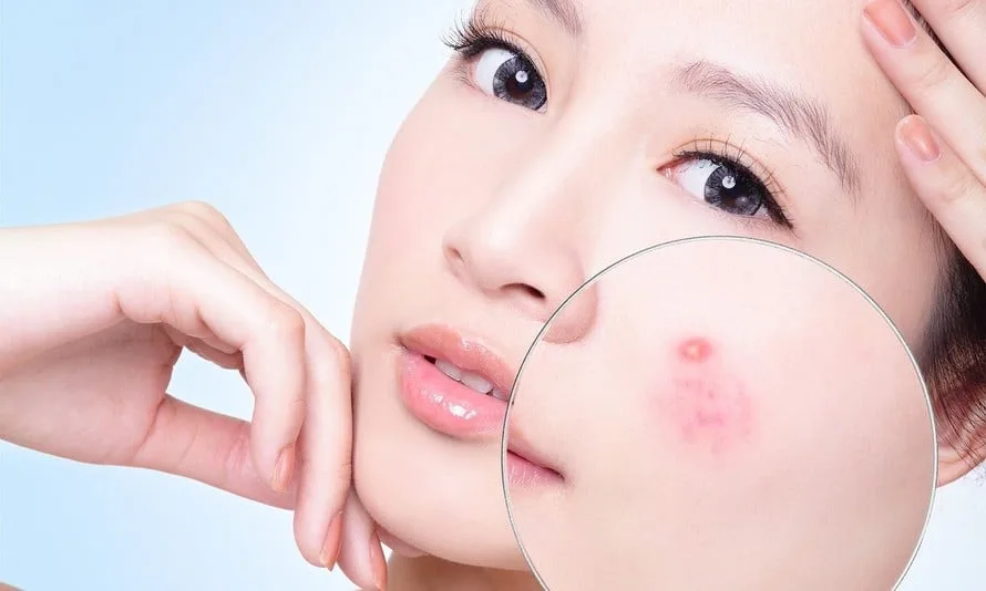 Retinol nào tốt nhất hiện nay? Gợi ý những sản phẩm được đánh giá cao nhất