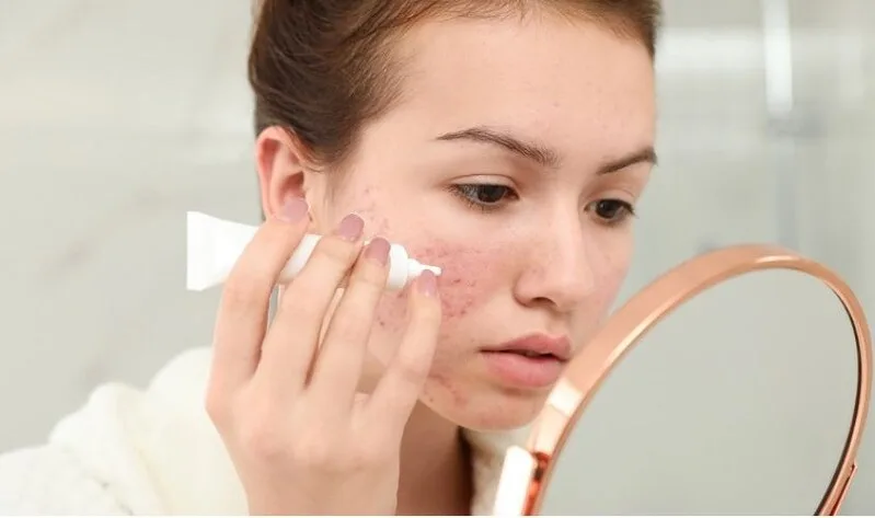 Sản phẩm đặc trị cần được lựa chọn theo tình trạng mụn, sắc tố, dầu thừa hoặc dấu hiệu lão hóa của làn da.