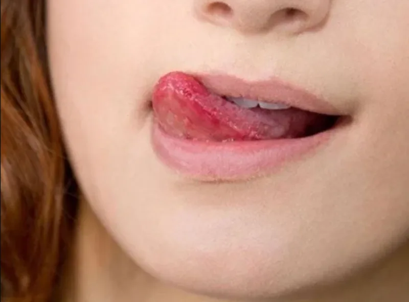 Thời tiết, thói quen liếm môi và mỹ phẩm có thể khiến môi khô bong tróc.