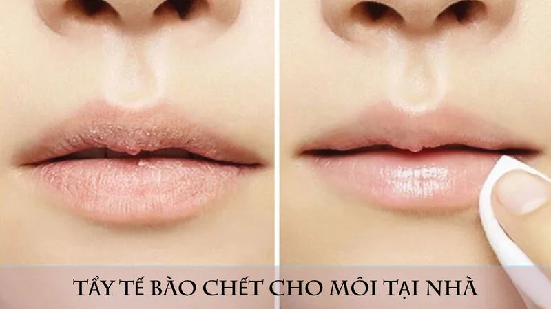 Tẩy tế bào chết môi tại nhà giúp làm mềm và loại bỏ nhẹ lớp da bong.